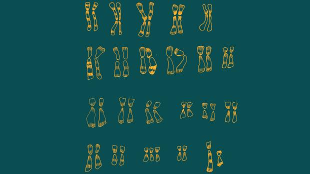 Karyotype of a person with Down's Syndrome Karyotype of a person with Down's Syndrome
