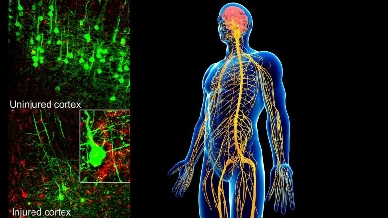 Inset images: Injured and uninjured Coretx. Source: Single-Nuclei Sequencing Reveals a Robust Corticospinal Response to Nearby Axotomy But Overall Insensitivity to Spinal Injury (https://doi.org/10.1523/JNEUROSCI.1508-24.2024) Nervous system with inset images showing injured and uninjuret cortex