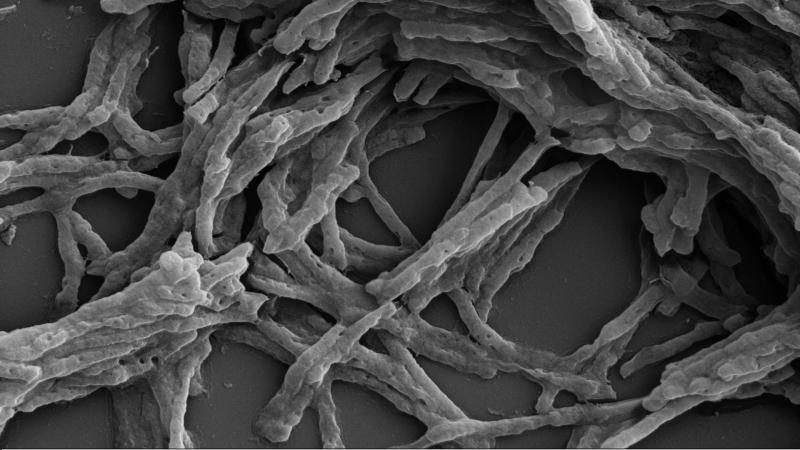 Mycobacterium smegmatis visualized under scanning electron microscopy. Image - Wikimedia commons, CC-BY-SA 4.0 Close Connections: Topoisomerase enzymes, which alleviate DNA stress, connect with critical cell functions