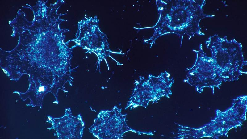 New drug pits cell’s biocidal system against cervical cancer New drug pits cell’s biocidal system against cervical cancer
