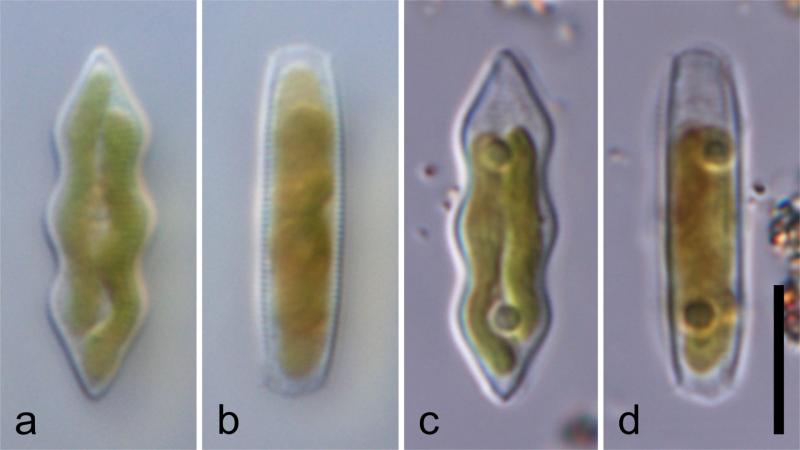 Images from Roy et.al, 2019, Phycological Research Looking through 'living glass', researchers discover a new genus of diatoms from India and China