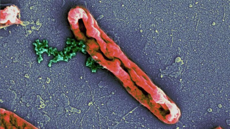 Photo : Deepesh Nagarajan. Antimicrobial peptides disrupting the E. coli cell membrane (orange). The bacterial chromosome (green) can be seen leaking out. Photo : Deepesh Nagarajan. Antimicrobial peptides disrupting the E. coli cell membrane (orange). The bacterial chromosome (green) can be seen leaking out.