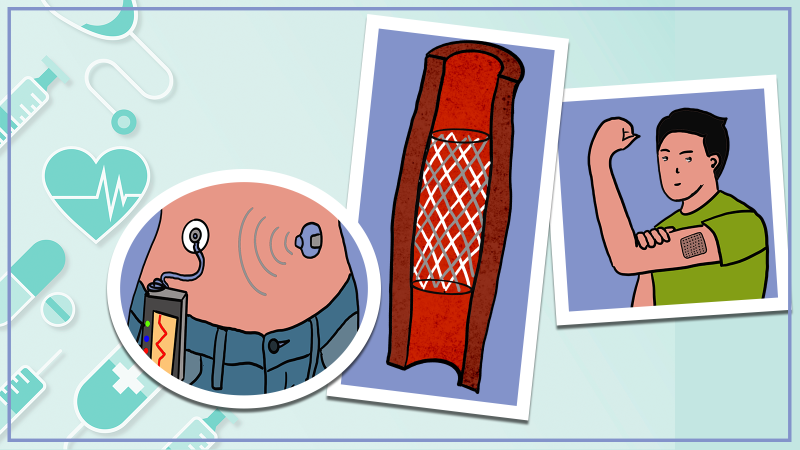 Image by Scientifickly Advanced drug delivery by wearbles and implants: our saviours