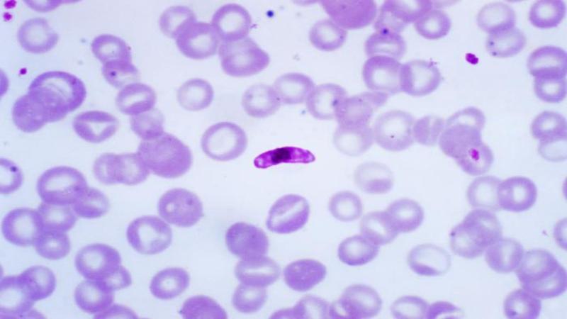 Macrogametocyte of the parasite Plasmodium falciparum. Image for representational purposes only. Credits - Centers for Disease Control and Prevention, under Wikimedia Commons Public Domain. Study explores how blood parasites spread among birds in the Western Ghats