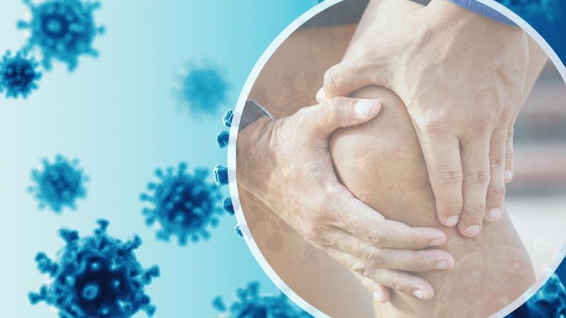 The emerging association between COVID-19 and Rheumatoid Arthritis The emerging association between COVID-19 and Rheumatoid Arthritis