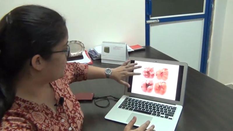 Researcher Richa Mishra explaining the characteristics of chronic TB infection in lungs. Photo: Ananya. IISc researchers use an anti-malarial drug to increase the effectiveness of anti-tuberculosis drugs