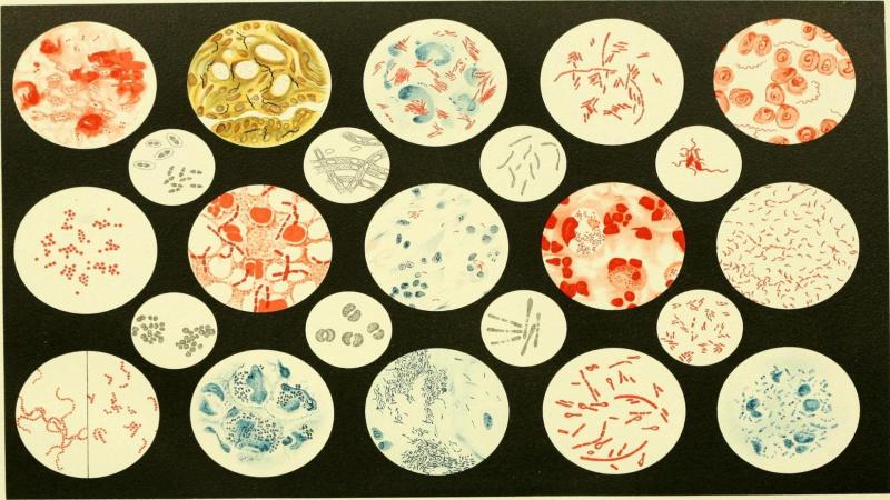 New insights into vaginal microbes may help to reduce premature birth