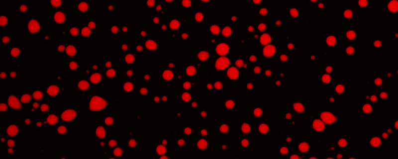 Microscopic image representing formation of liquid condensates by a protein in a solution. 