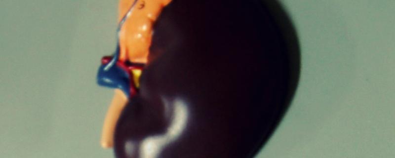 A model of a kidney