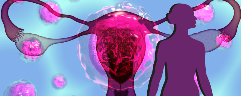 Five markers identified for diagnosing ovarian cancer