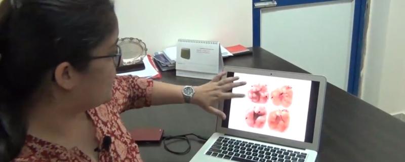 IISc researchers use an anti-malarial drug to increase the effectiveness of anti-tuberculosis drugs