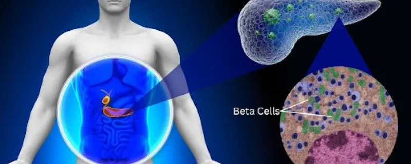 Collagen might be making type 2 diabetes worse, finds study